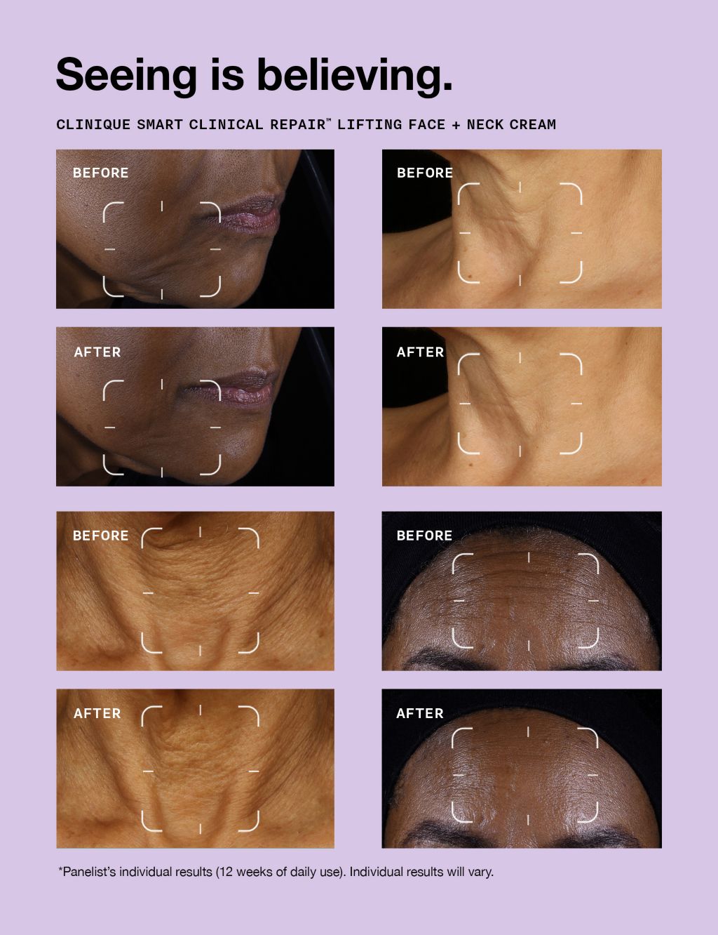 Clinique Smart Clinical Repair™ Lifting Face + Neck Cream 50ml 1 of 5