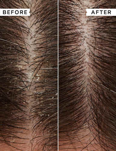 Flaky/Itchy Scalp Hydrating Conditioner 3 of 4