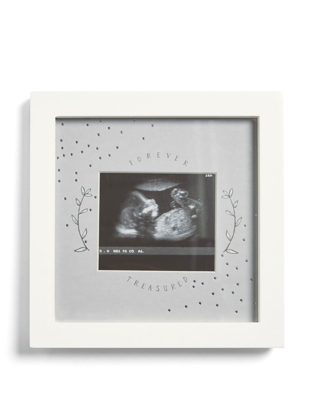 Forever Treasured Baby Scan Photo Frame